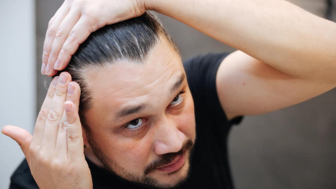 Hair loss