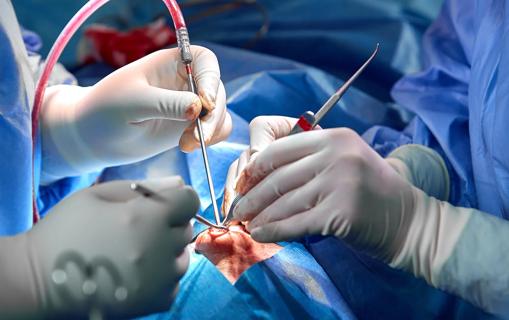 Nasal surgery