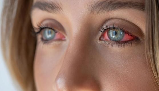 Person with two red eyes