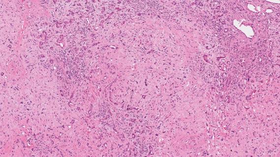 Pathology image